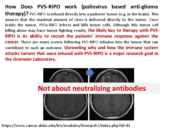 How Does PVS-RIPO work (poliovirus based anti-glioma therapy)? PVS-RIPO is infused directly into a