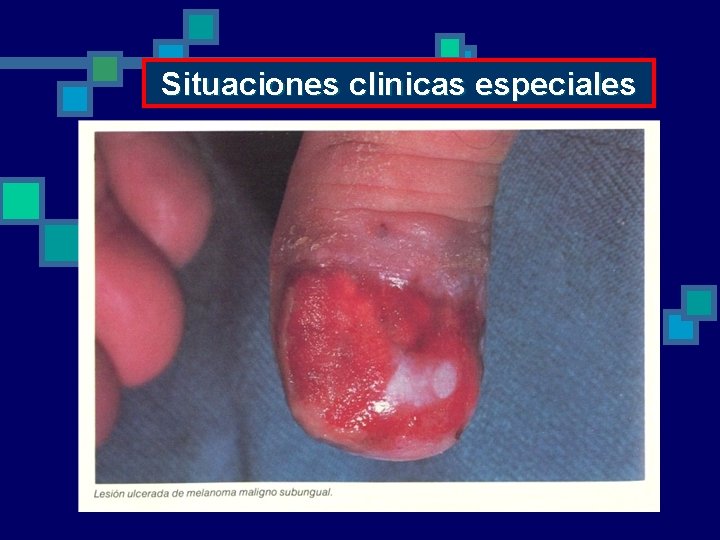 Situaciones clinicas especiales 