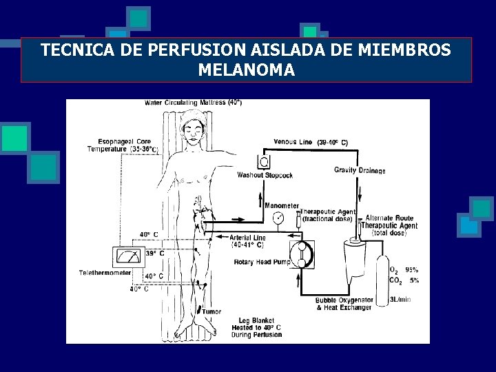 TECNICA DE PERFUSION AISLADA DE MIEMBROS MELANOMA 