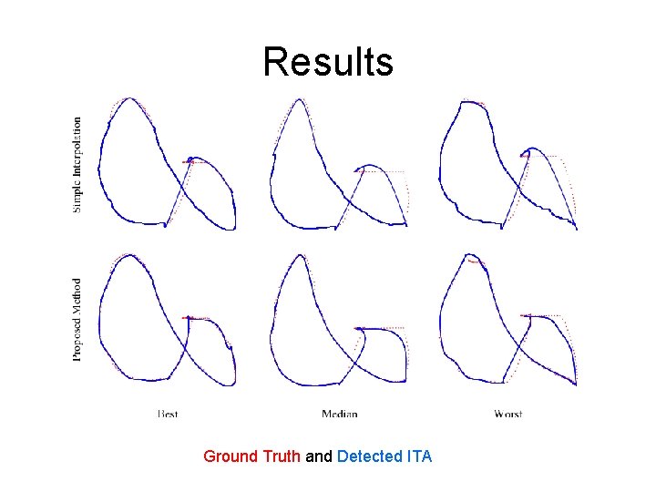 Results Ground Truth and Detected ITA Results Ground Truth and Detected ITA