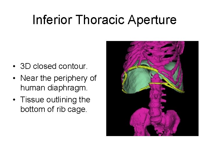 Inferior Thoracic Aperture • 3 D closed contour. • Near the periphery of human Inferior Thoracic Aperture • 3 D closed contour. • Near the periphery of human
