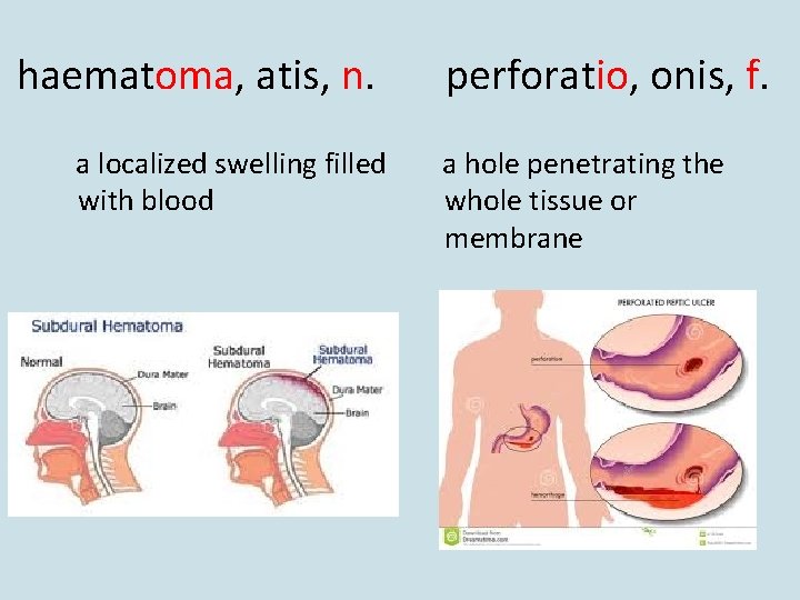 haematoma, atis, n. a localized swelling filled with blood perforatio, onis, f. a hole haematoma, atis, n. a localized swelling filled with blood perforatio, onis, f. a hole