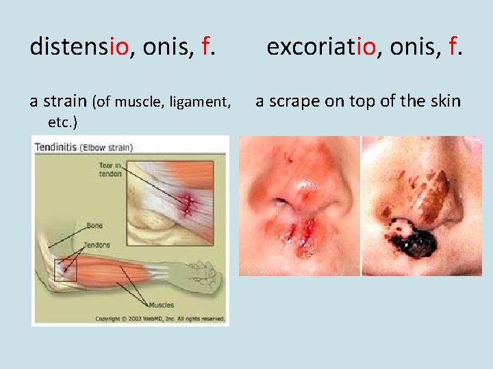 distensio, onis, f. a strain (of muscle, ligament, etc. ) excoriatio, onis, f. a distensio, onis, f. a strain (of muscle, ligament, etc. ) excoriatio, onis, f. a