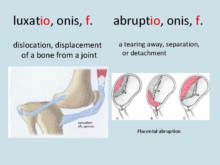 luxatio, onis, f. dislocation, displacement of a bone from a joint abruptio, onis, f. luxatio, onis, f. dislocation, displacement of a bone from a joint abruptio, onis, f.