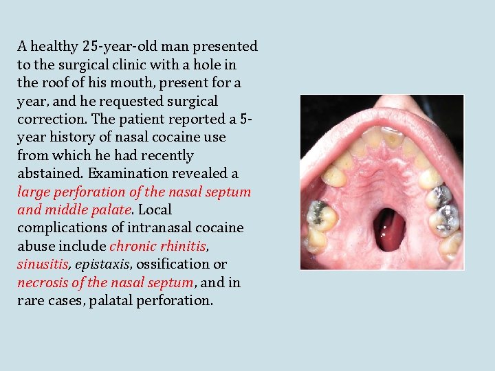 A healthy 25 -year-old man presented to the surgical clinic with a hole in A healthy 25 -year-old man presented to the surgical clinic with a hole in