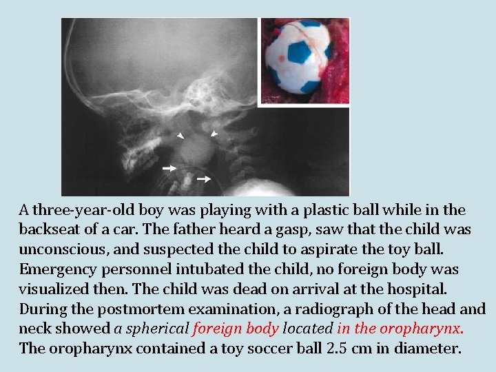 A three-year-old boy was playing with a plastic ball while in the backseat of A three-year-old boy was playing with a plastic ball while in the backseat of
