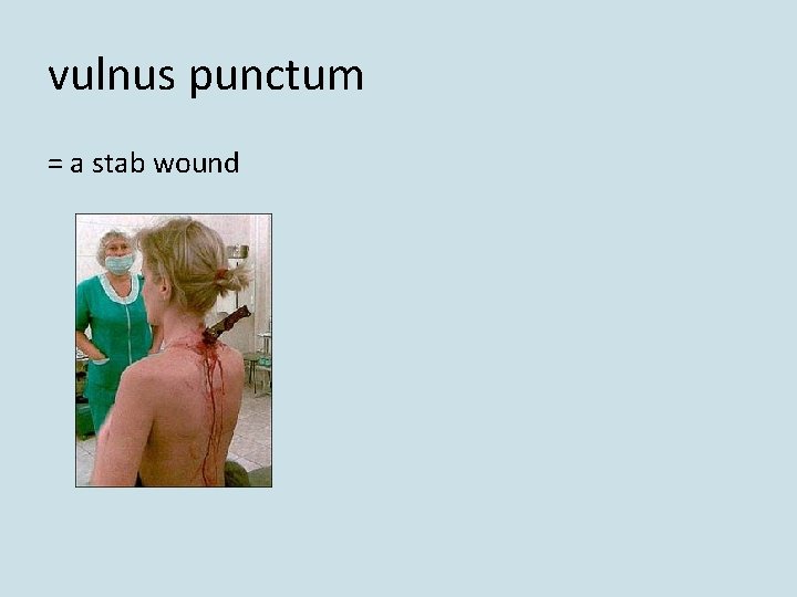 vulnus punctum = a stab wound vulnus punctum = a stab wound