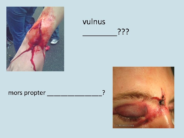 vulnus ____? ? ? mors propter ________? vulnus ____? ? ? mors propter ________?