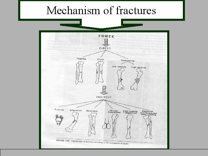 Mechanism of fractures 