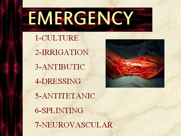 EMERGENCY 1 -CULTURE 2 -IRRIGATION 3 -ANTIBUTIC 4 -DRESSING 5 -ANTITETANIC 6 -SPLINTING 7