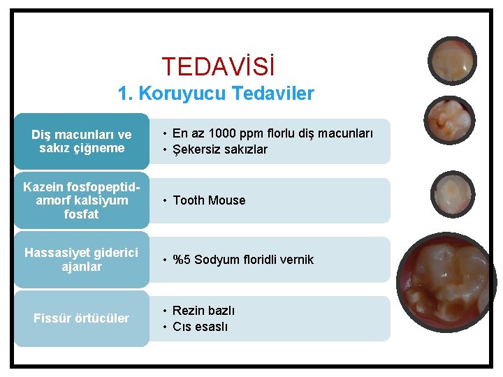 TEDAVİSİ 1. Koruyucu Tedaviler Diş macunları ve sakız çiğneme • En az 1000 ppm