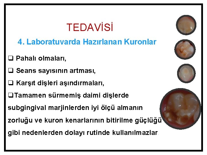 TEDAVİSİ 4. Laboratuvarda Hazırlanan Kuronlar q Pahalı olmaları, q Seans sayısının artması, q Karşıt