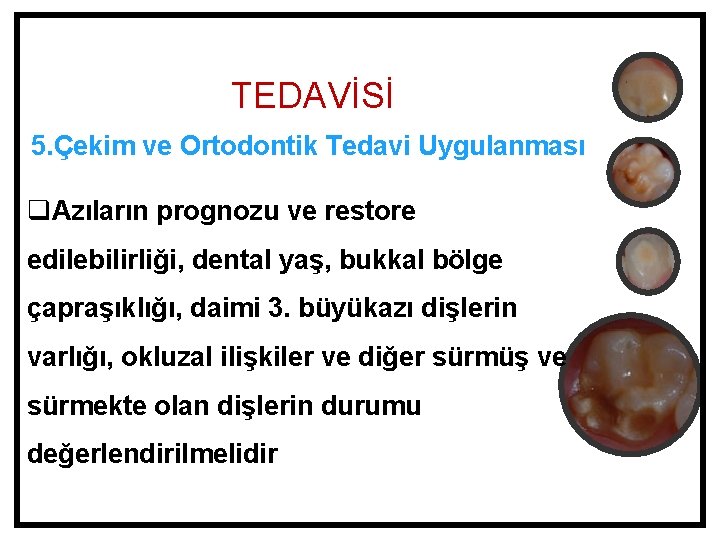 TEDAVİSİ 5. Çekim ve Ortodontik Tedavi Uygulanması q. Azıların prognozu ve restore edilebilirliği, dental