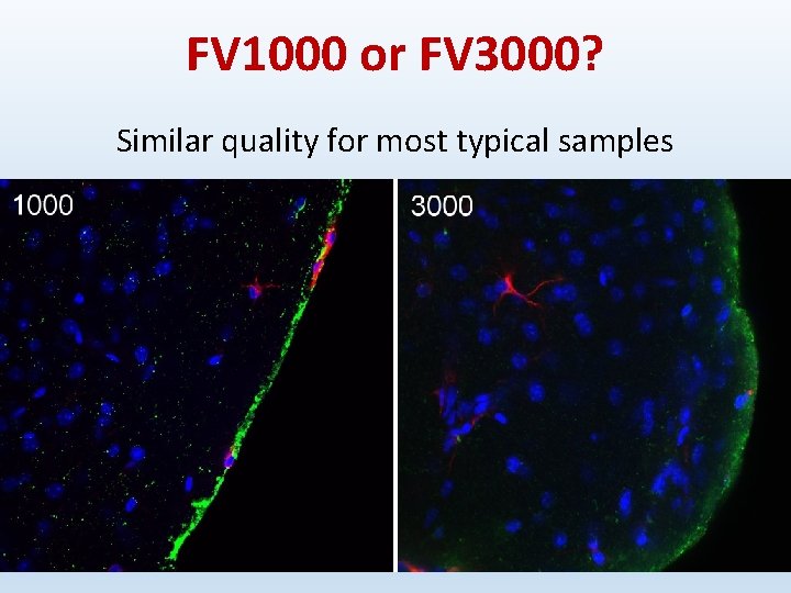 FV 1000 or FV 3000? Similar quality for most typical samples 
