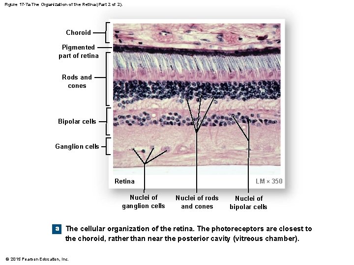 Figure 17 -7 a The Organization of the Retina (Part 2 of 2). Choroid Figure 17 -7 a The Organization of the Retina (Part 2 of 2). Choroid