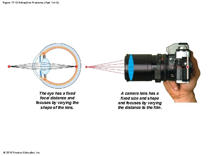 Figure 17 -13 Refractive Problems (Part 1 of 5). The eye has a fixed Figure 17 -13 Refractive Problems (Part 1 of 5). The eye has a fixed