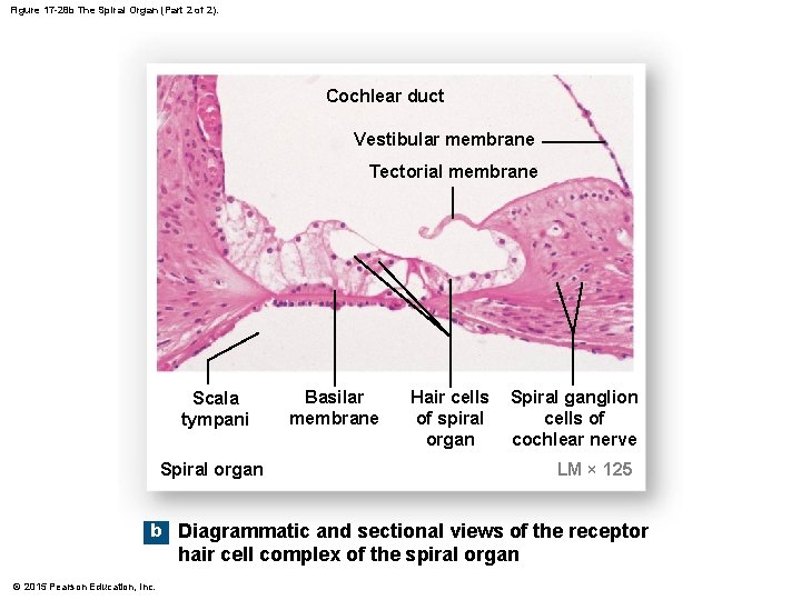 Figure 17 -28 b The Spiral Organ (Part 2 of 2). Cochlear duct Vestibular Figure 17 -28 b The Spiral Organ (Part 2 of 2). Cochlear duct Vestibular