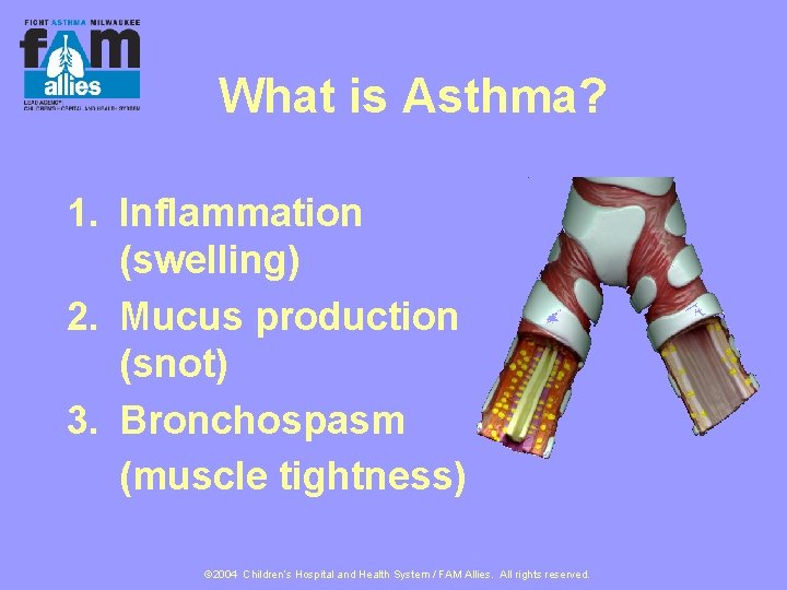 What is Asthma? 1. Inflammation (swelling) 2. Mucus production (snot) 3. Bronchospasm (muscle tightness)