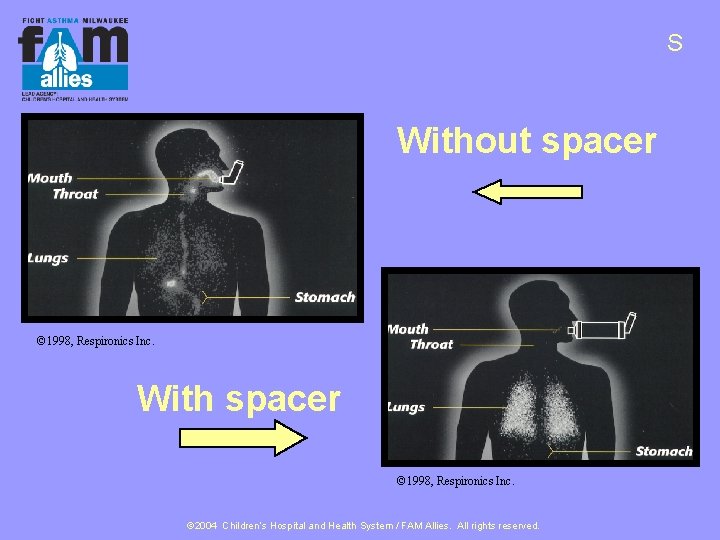 S Without spacer © 1998, Respironics Inc. With spacer © 1998, Respironics Inc. ©