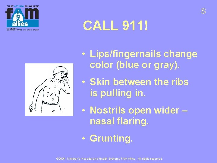 S CALL 911! • Lips/fingernails change color (blue or gray). • Skin between the