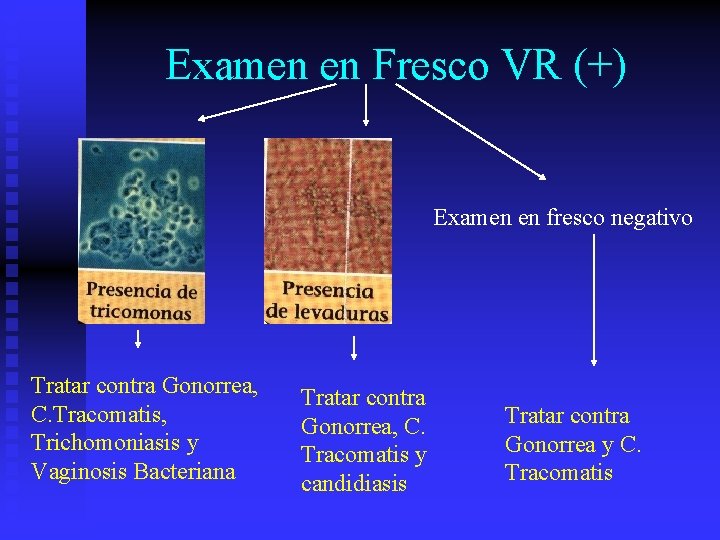 Examen en Fresco VR (+) Examen en fresco negativo Tratar contra Gonorrea, C. Tracomatis,