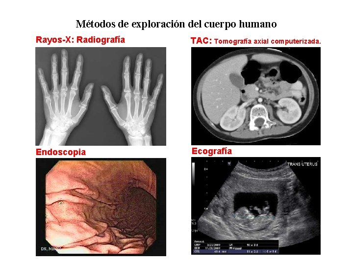 01 Métodos de exploración del cuerpo humano Rayos-X: Radiografía TAC: Tomografía axial computerizada. Endoscopia 01 Métodos de exploración del cuerpo humano Rayos-X: Radiografía TAC: Tomografía axial computerizada. Endoscopia