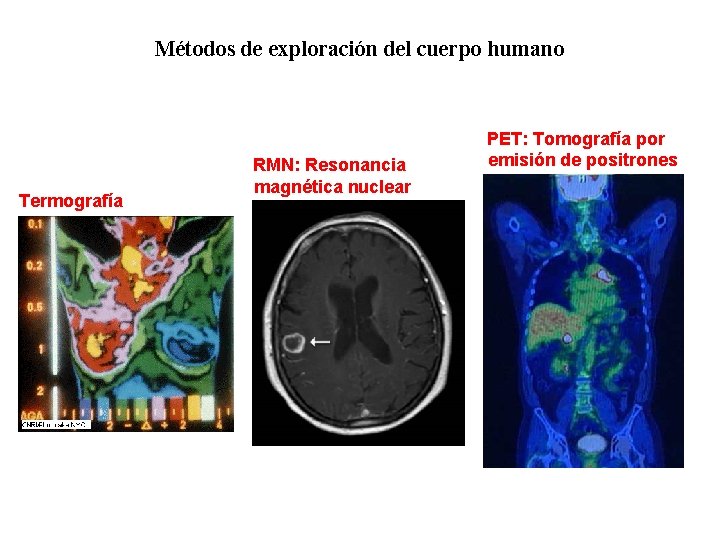 01 Métodos de exploración del cuerpo humano Termografía RMN: Resonancia magnética nuclear PET: Tomografía 01 Métodos de exploración del cuerpo humano Termografía RMN: Resonancia magnética nuclear PET: Tomografía