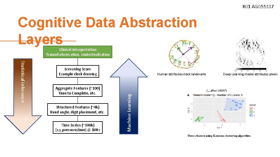 R 01 AG 055337 Cognitive Data Abstraction Layers Clinical Interpretation Trained observation, contextualization Aggregate