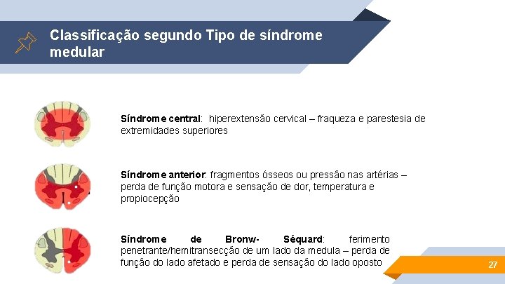 Classificação segundo Tipo de síndrome medular Síndrome central: hiperextensão cervical – fraqueza e parestesia