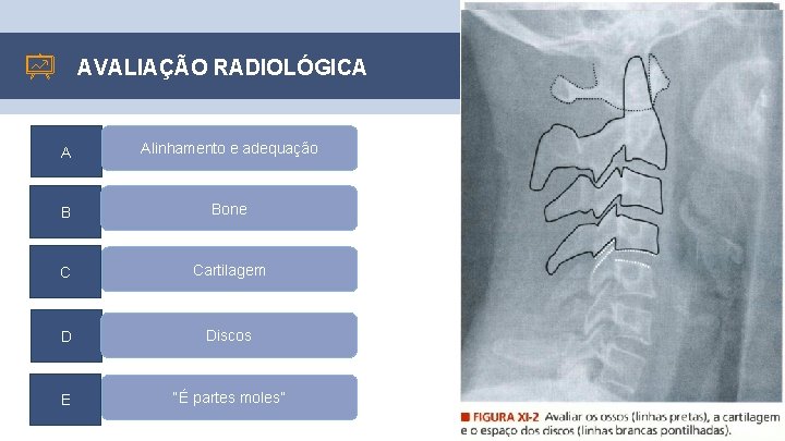 AVALIAÇÃO RADIOLÓGICA A Alinhamento e adequação B Bone C Cartilagem D Discos E “É