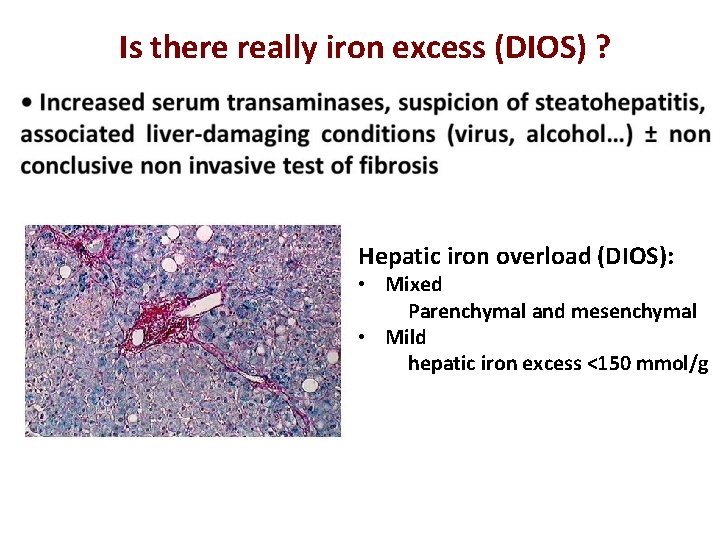 Is there really iron excess (DIOS) ? Hepatic iron overload (DIOS): • Mixed Parenchymal