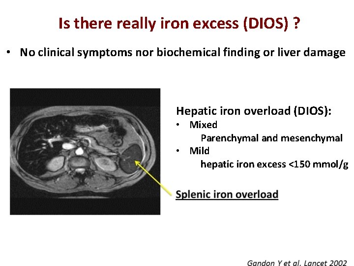 Is there really iron excess (DIOS) ? • No clinical symptoms nor biochemical finding