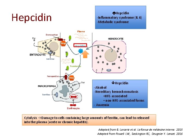 Hepcidin -Inflammatory syndrome (IL 6) -Metabolic syndrome Hepcidin -Alcohol -Hereditary hemochromatosis ▪HFE-associated ▪ non-HFE-associated