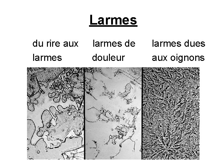 Larmes du rire aux larmes de douleur larmes dues aux oignons 