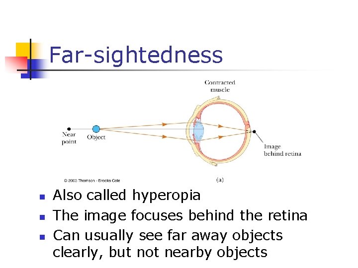 Far-sightedness n n n Also called hyperopia The image focuses behind the retina Can