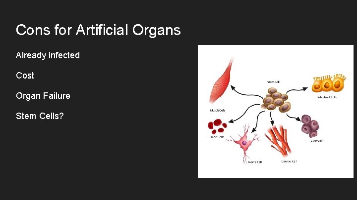 Cons for Artificial Organs Already infected Cost Organ Failure Stem Cells? 