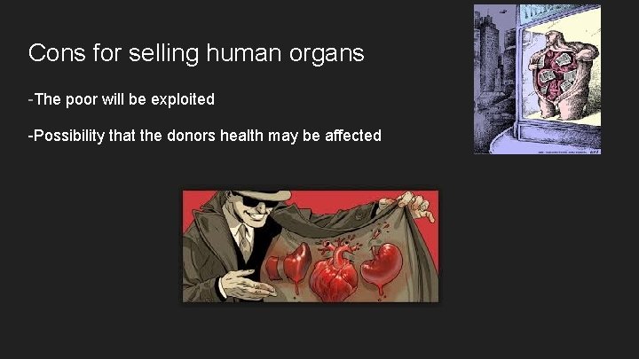Cons for selling human organs -The poor will be exploited -Possibility that the donors