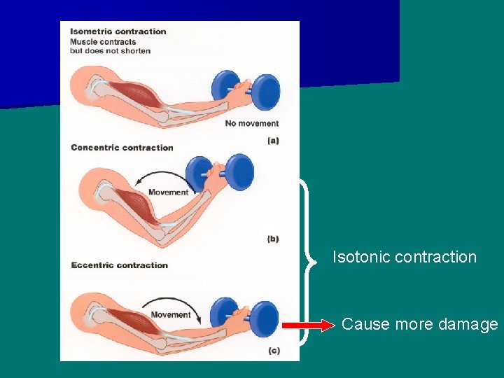 Isotonic contraction Cause more damage 