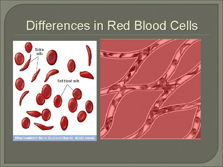 Differences in Red Blood Cells 