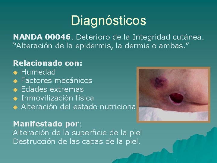 Metodo Enfermero PIE DIABETICO u VALORACION INSUFICIENCIA VENOSA