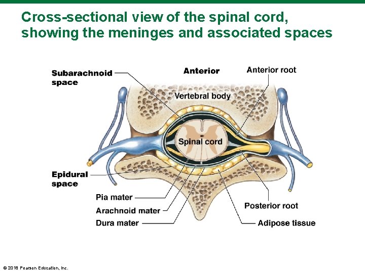 Cross-sectional view of the spinal cord, showing the meninges and associated spaces © 2018