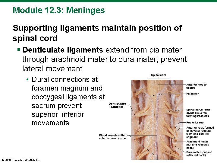 Module 12. 3: Meninges Supporting ligaments maintain position of spinal cord § Denticulate ligaments