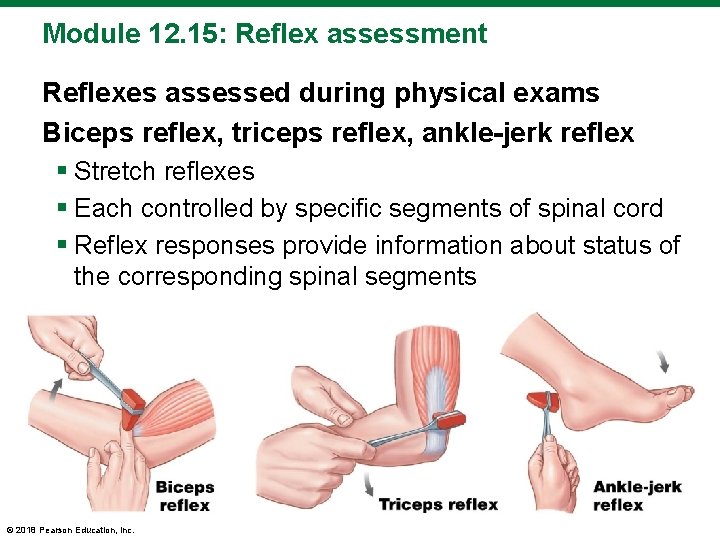 Module 12. 15: Reflex assessment Reflexes assessed during physical exams Biceps reflex, triceps reflex,