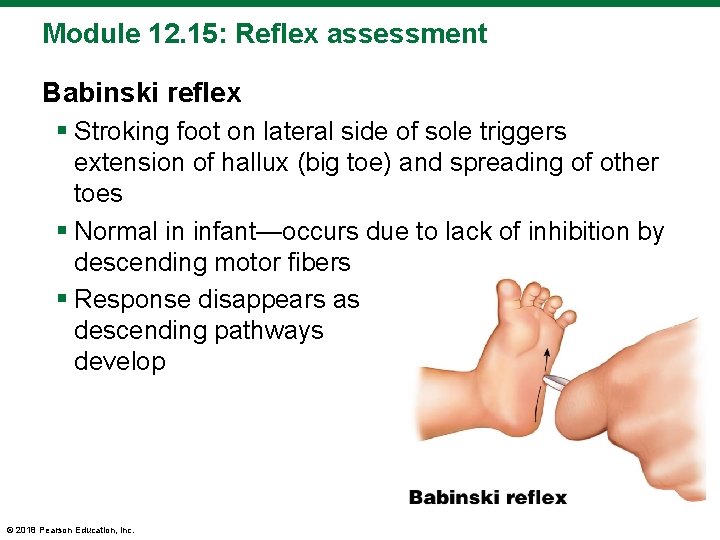 Module 12. 15: Reflex assessment Babinski reflex § Stroking foot on lateral side of