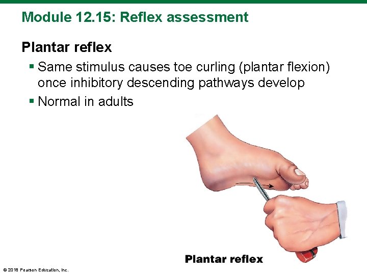 Module 12. 15: Reflex assessment Plantar reflex § Same stimulus causes toe curling (plantar