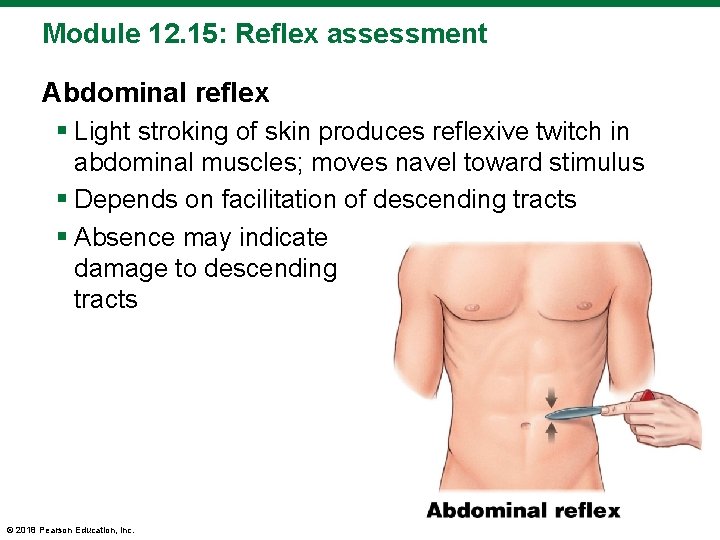 Module 12. 15: Reflex assessment Abdominal reflex § Light stroking of skin produces reflexive