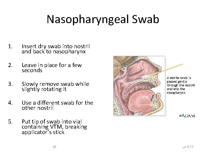 Nasopharyngeal Swab 1. Insert dry swab into nostril and back to nasopharynx 2. Leave