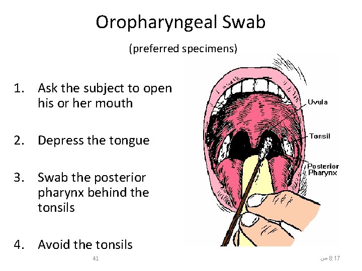 Oropharyngeal Swab (preferred specimens) 1. Ask the subject to open his or her mouth