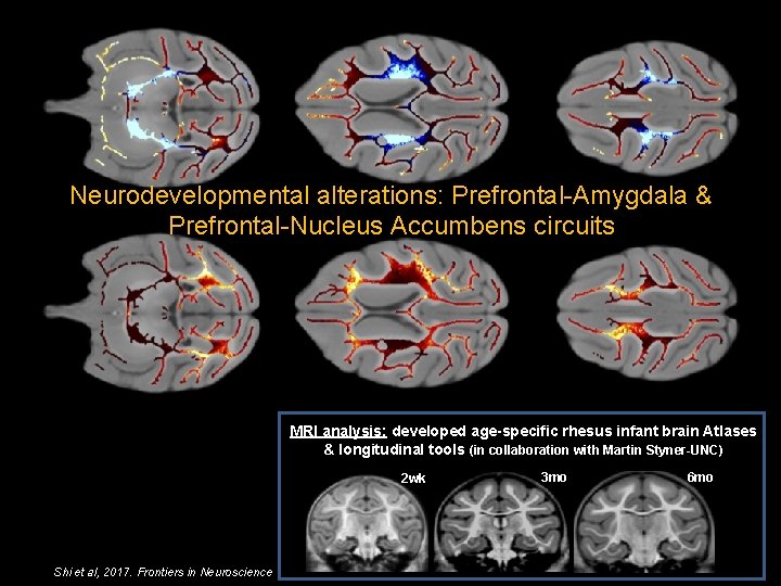 Neurodevelopmental alterations: Prefrontal-Amygdala & Prefrontal-Nucleus Accumbens circuits MRI analysis: developed age-specific rhesus infant brain