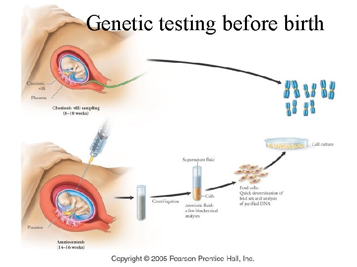 Genetic testing before birth 